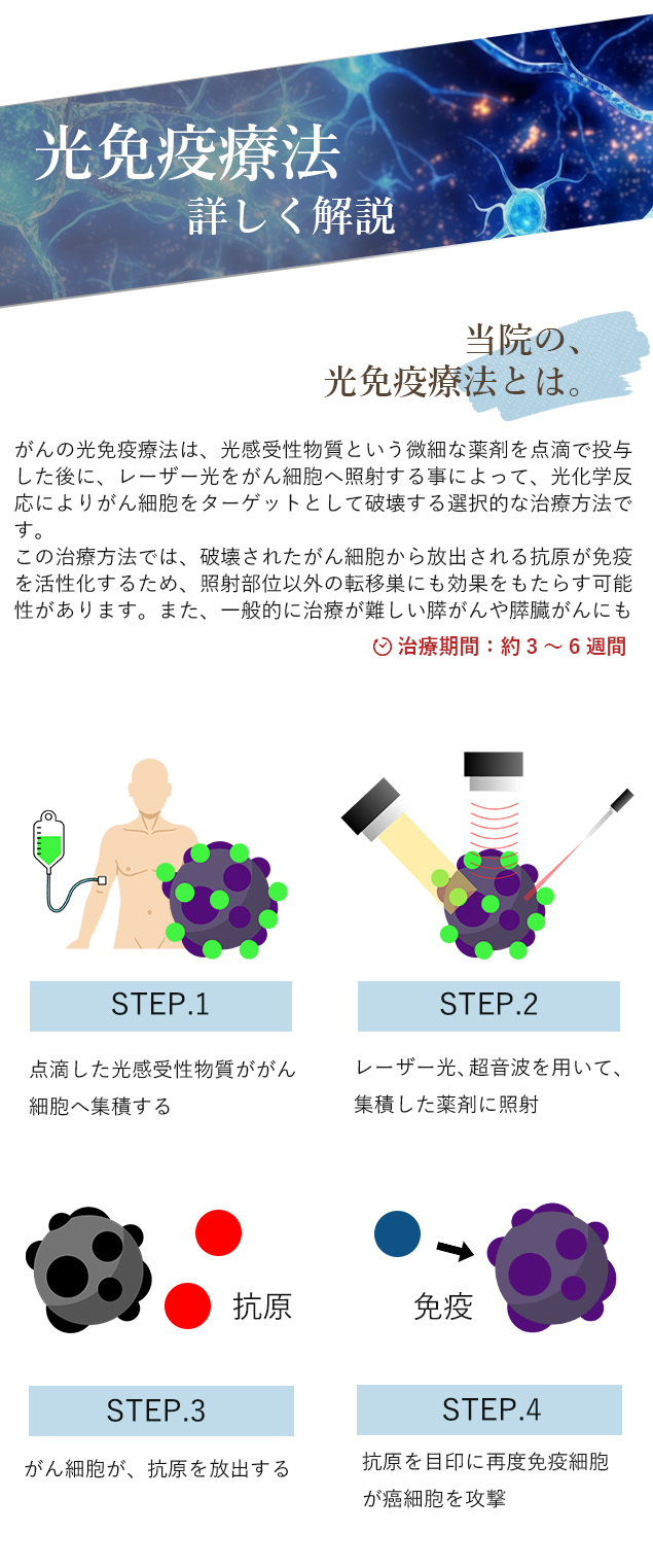 光免疫療法を詳しく解説