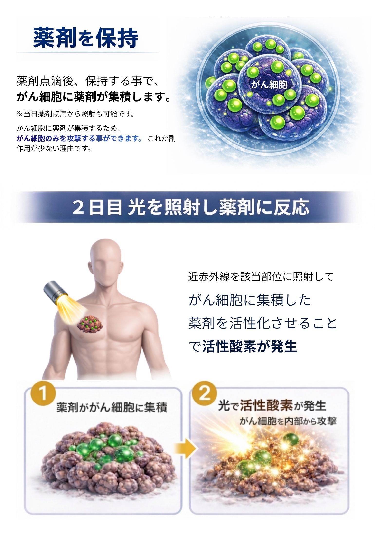 薬剤の保持、光を照射し薬剤に反応