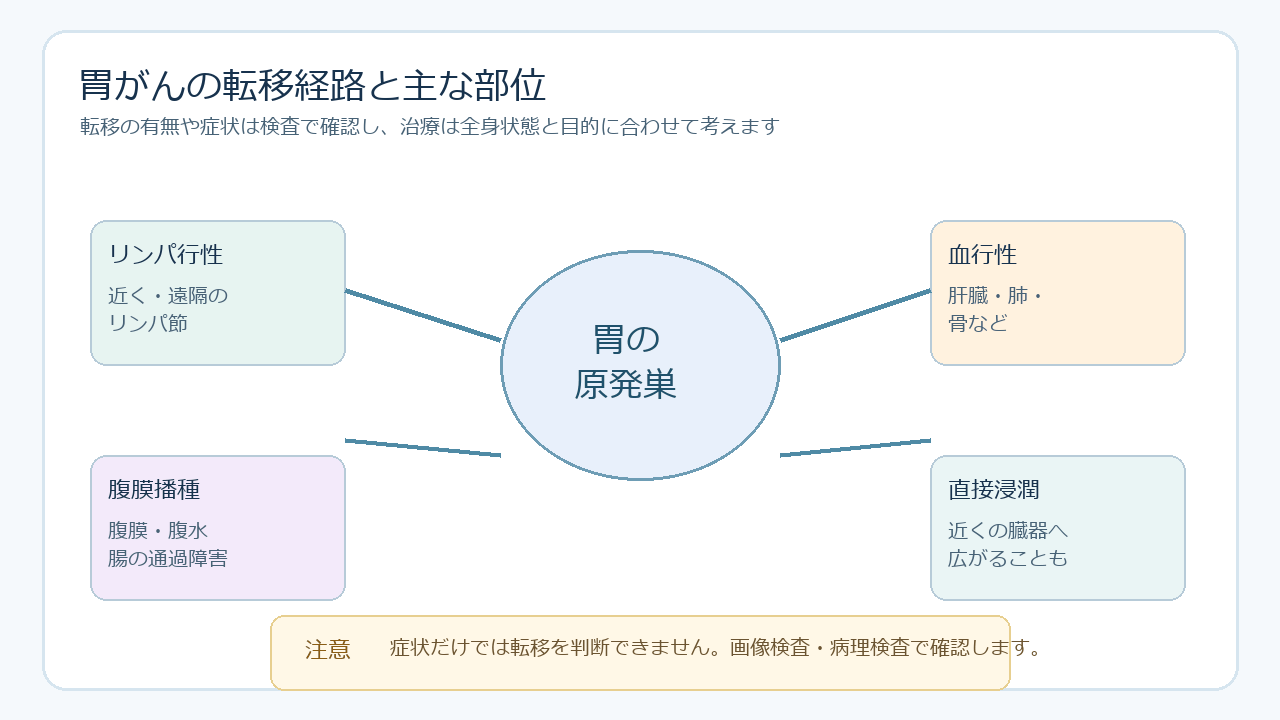 胃がんが転移しやすい部位と症状